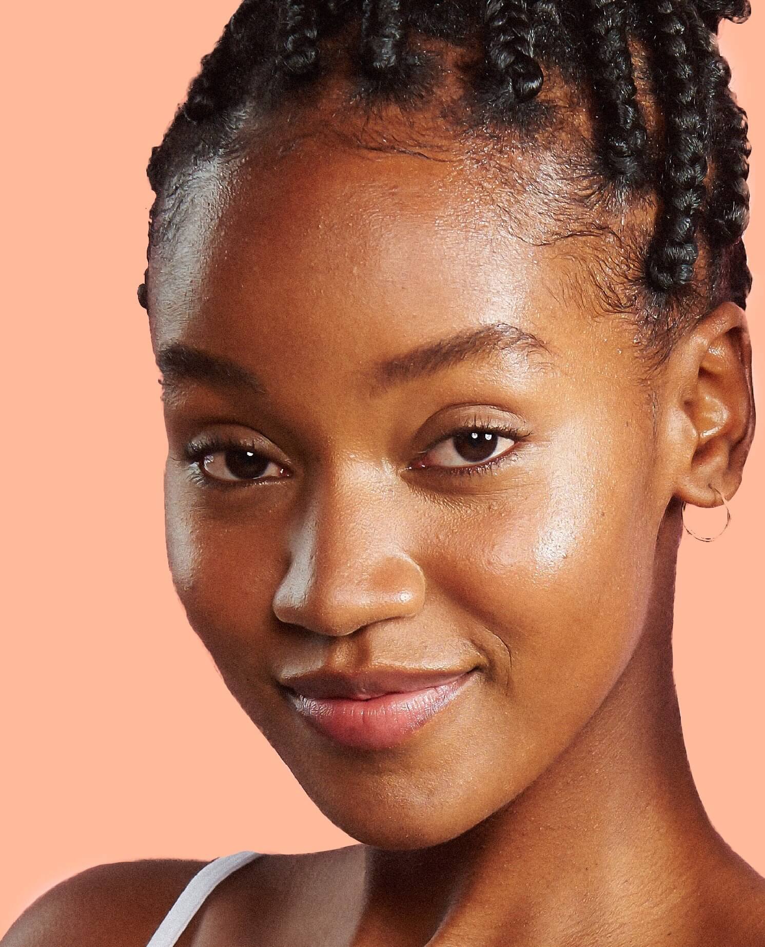 How to Tackle Hyperpigmentation