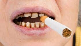 Does Nicotine cause teeth grinding?