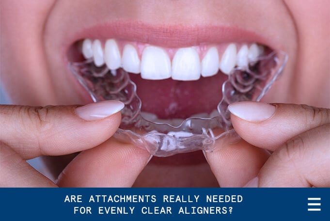 Are Attachments Really Needed for Evenly Clear Aligners?