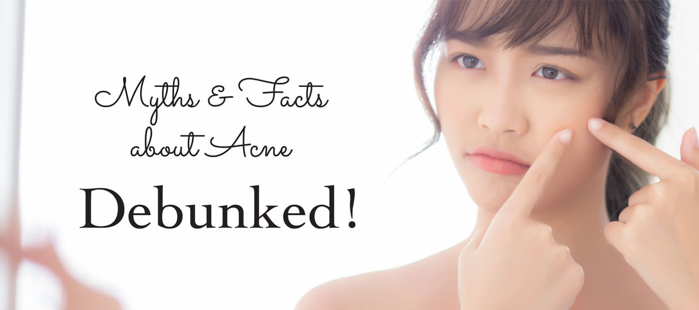 Myths and Facts about Acne Debunked!