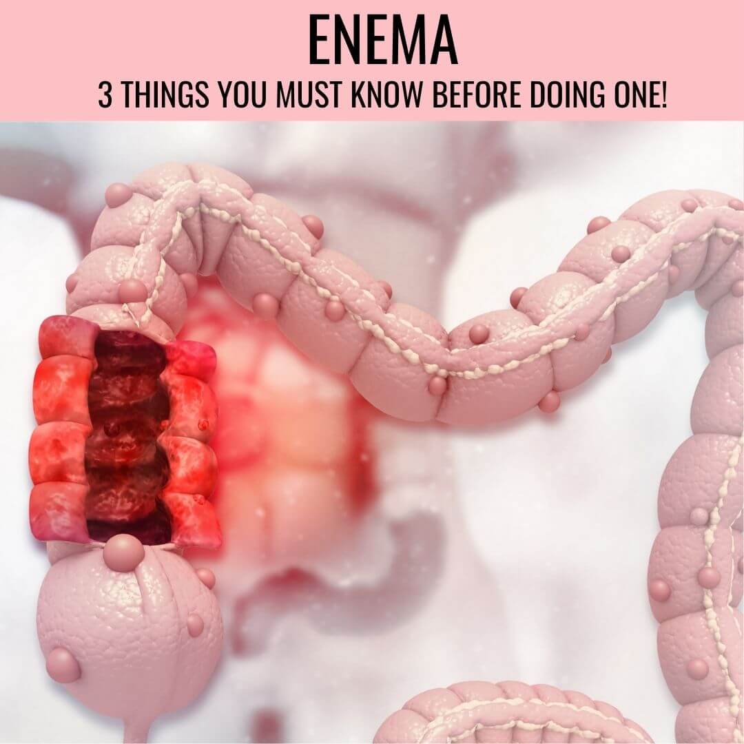 Enema: 3 Things You Must Know Prior to Doing One!