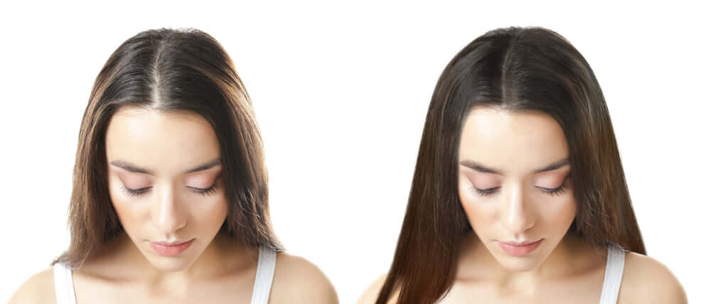 Do Biotin Tablets Make Your Hair Grow Fast? – Be Vivid You