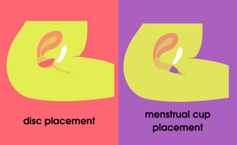 reusable menstrual disc and menstrual cup placement