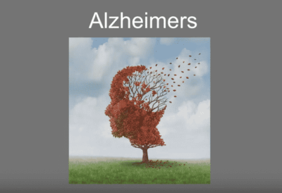 Micelle Curcumin vs Alzheimers