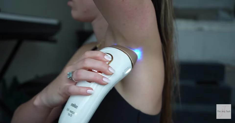 Braun IPL Review and Hair Removal Tutorial (4 Months Later...)
